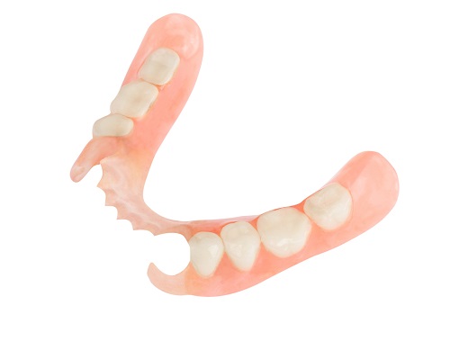 Osaline eemaldatav plaatprotees hammastele